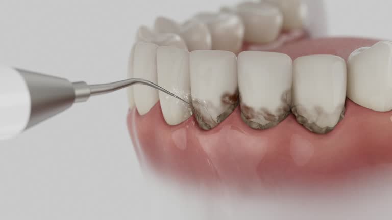 Reliable Dental Implants contractor in England, AR by Smile Center Dentistry
